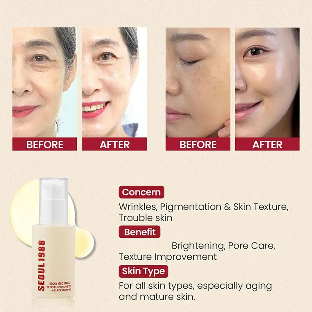 Korean SEOUL 1988 Skin Care Set - Retinol Eye Cream, Ginseng Niacinamide Serum, Cleanser, Lightens Fine Lines Dark Circle