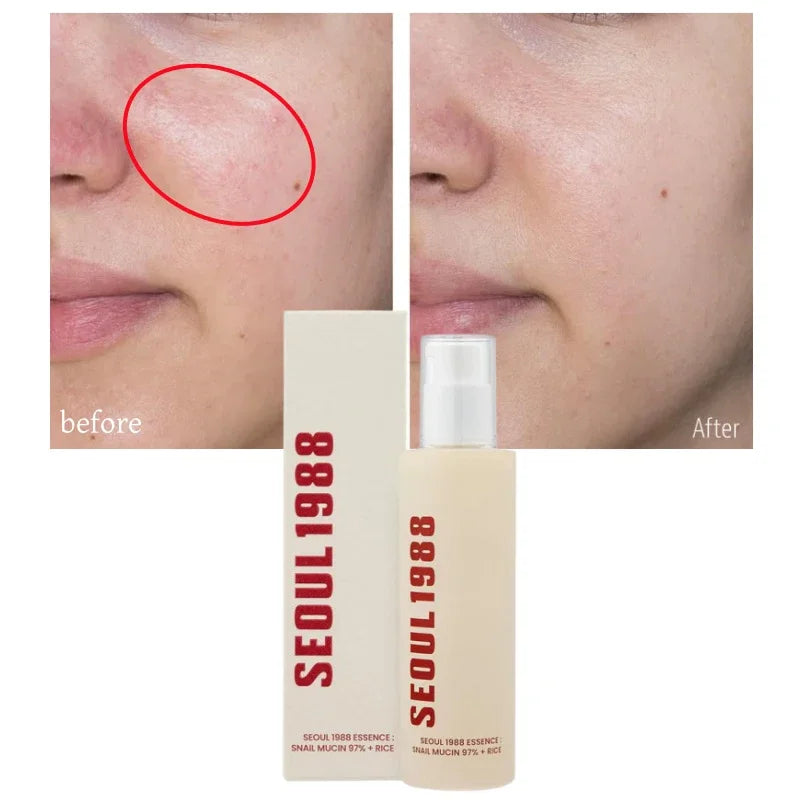 Korean Brand Skin Care Set Seoul 1988 Anti-aging Brightening Eye Cream Sunscreen Anti-wrinkle Essence Rice Cream Essence Water