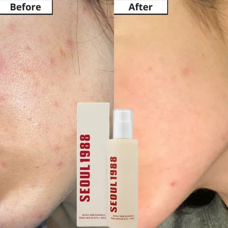 Korean Brand Skin Care Set Seoul 1988 Anti-aging Brightening Eye Cream Sunscreen Anti-wrinkle Essence Rice Cream Essence Water